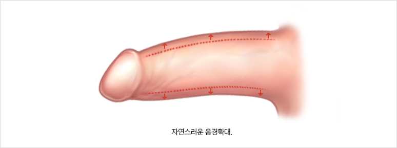 사진2 삽입