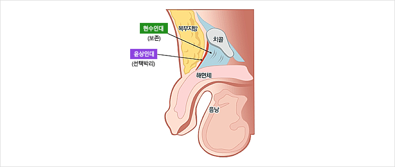 사진4 삽입