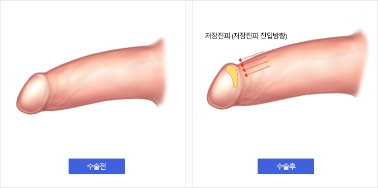 사진5 삽입